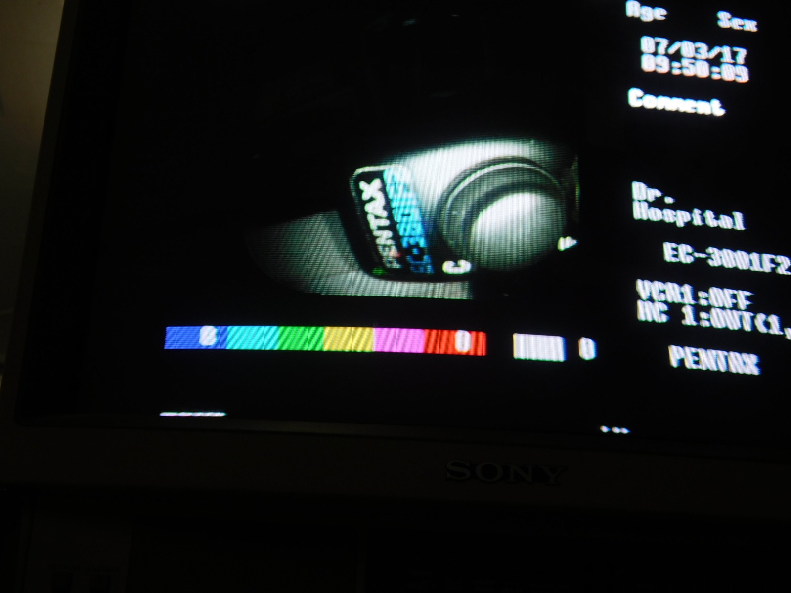 pentax-ec-3801-f2-coloskope-koloskop-videoendoskop-707
