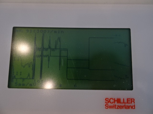 schiller-cs-6-12-3-6-12-kanal-ekg-mit-saugelektrodenarm-2322