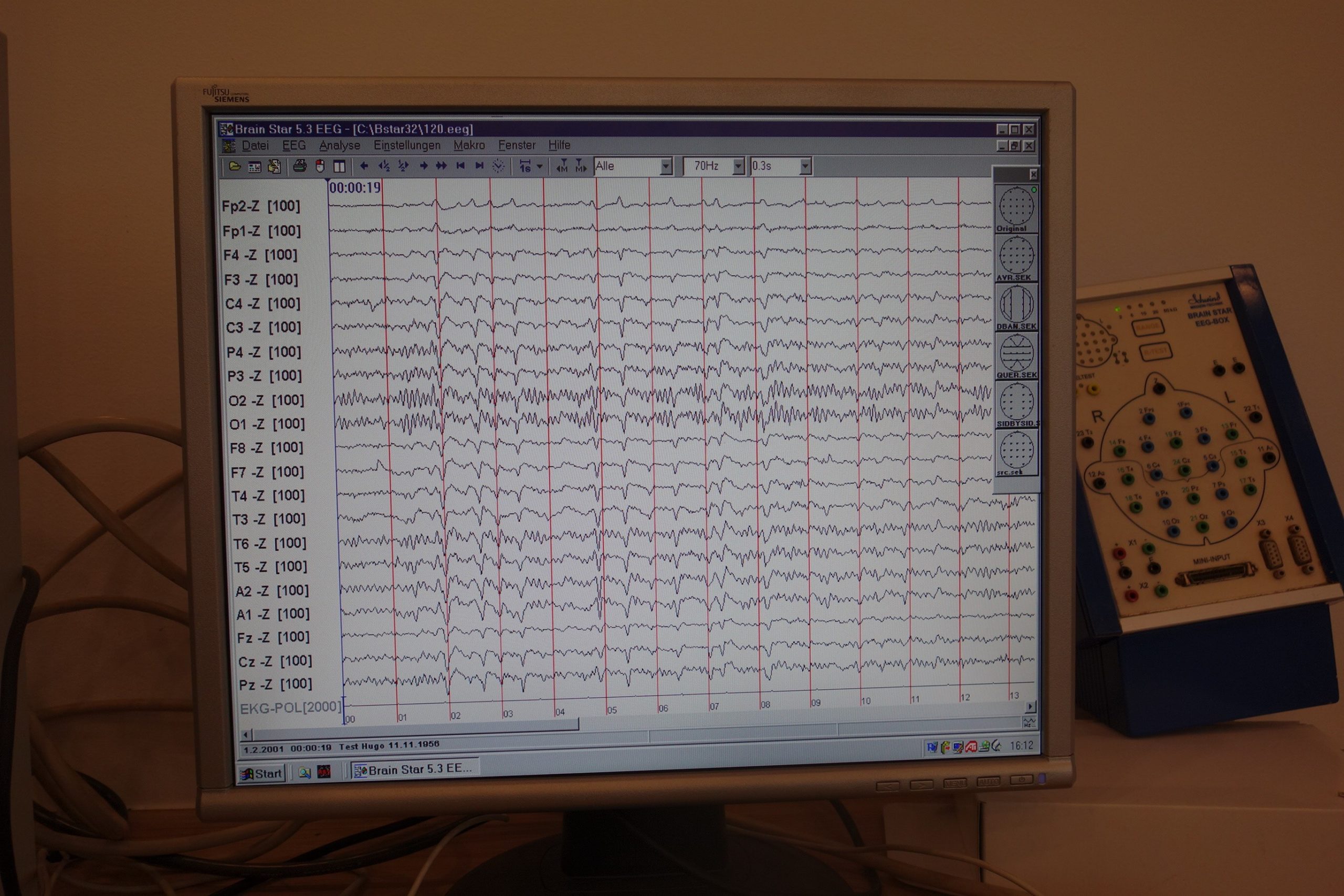 schwind-medizin-technik-brain-star-30-eeg-5138