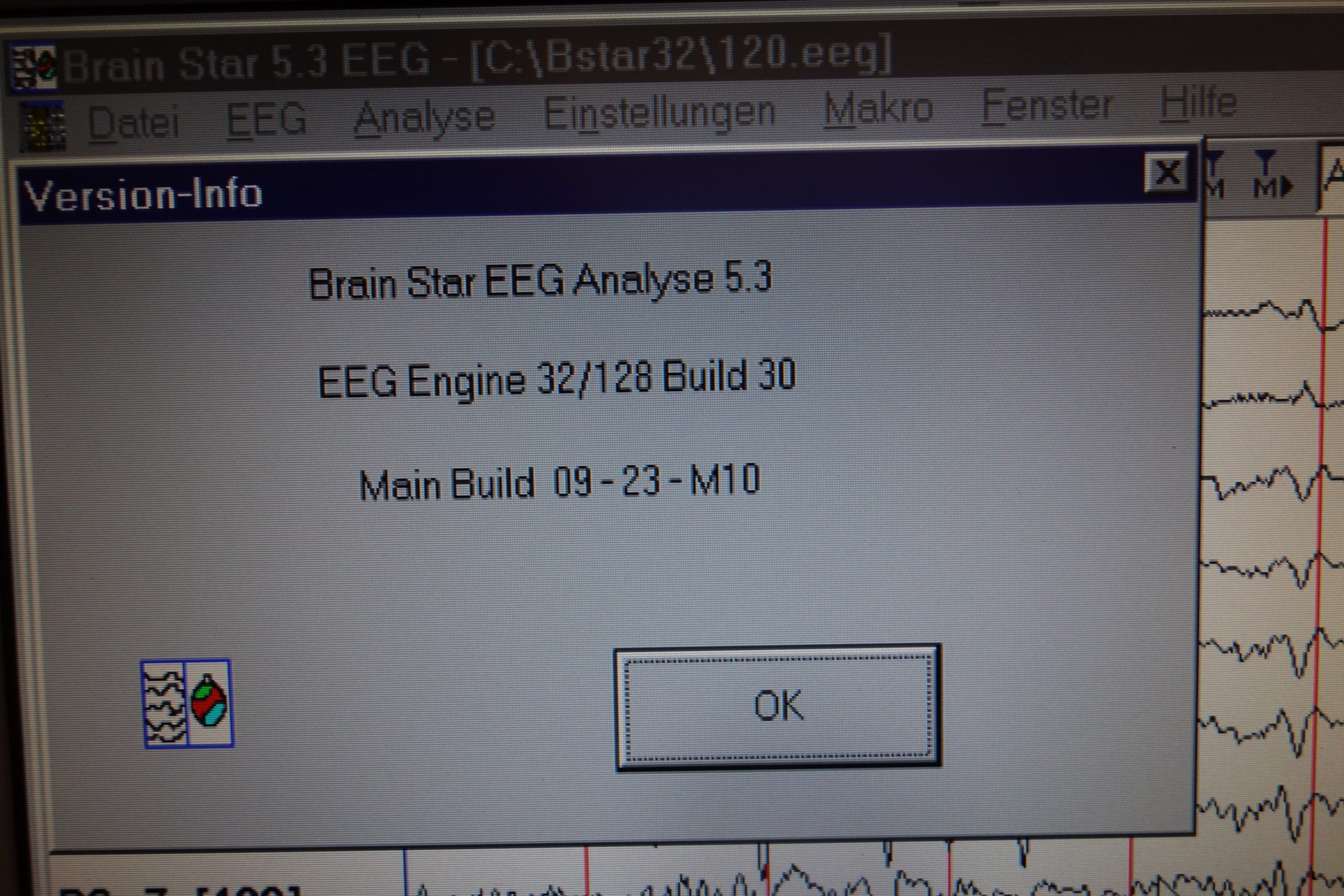 schwind-medizin-technik-brain-star-30-eeg-5139