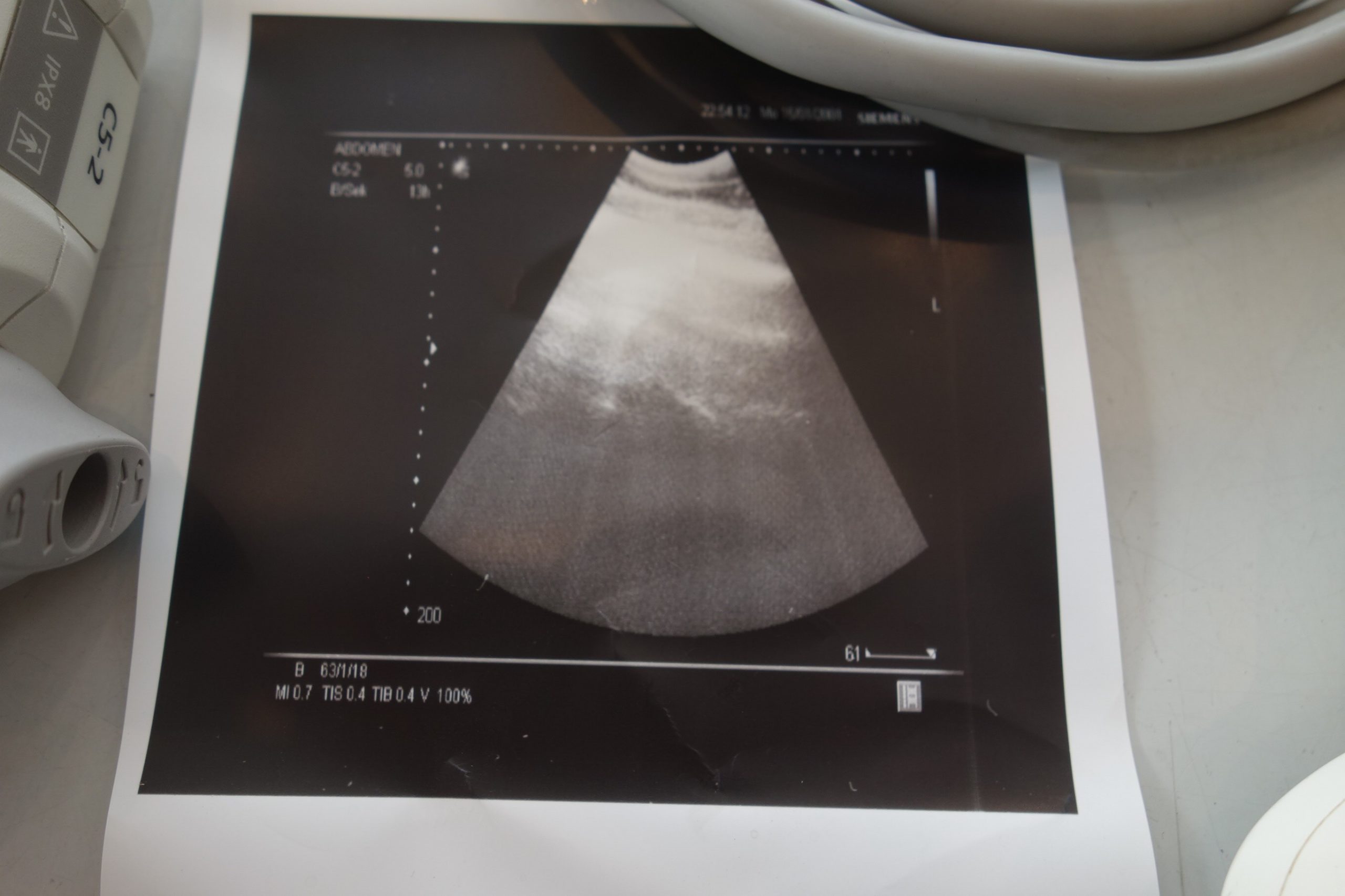 siemens-sonoline-g20-convex-sonde-abdomen-c5-2-4088