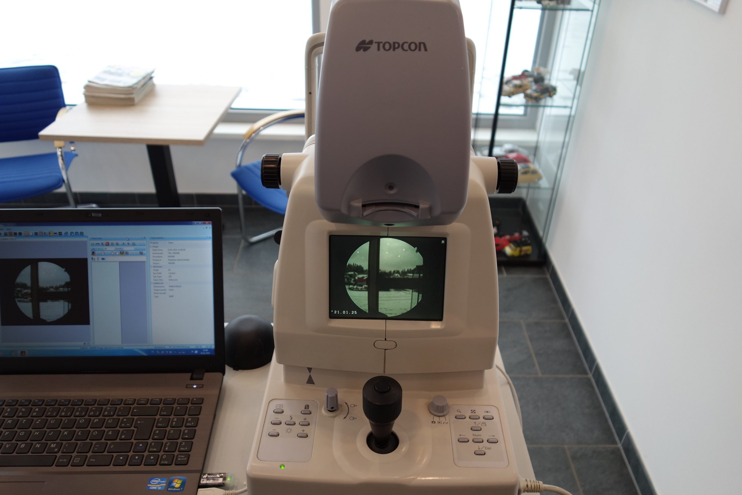 topcon-trc-nw200-non-mydriatic-retinal-camera-funduskamera-2533