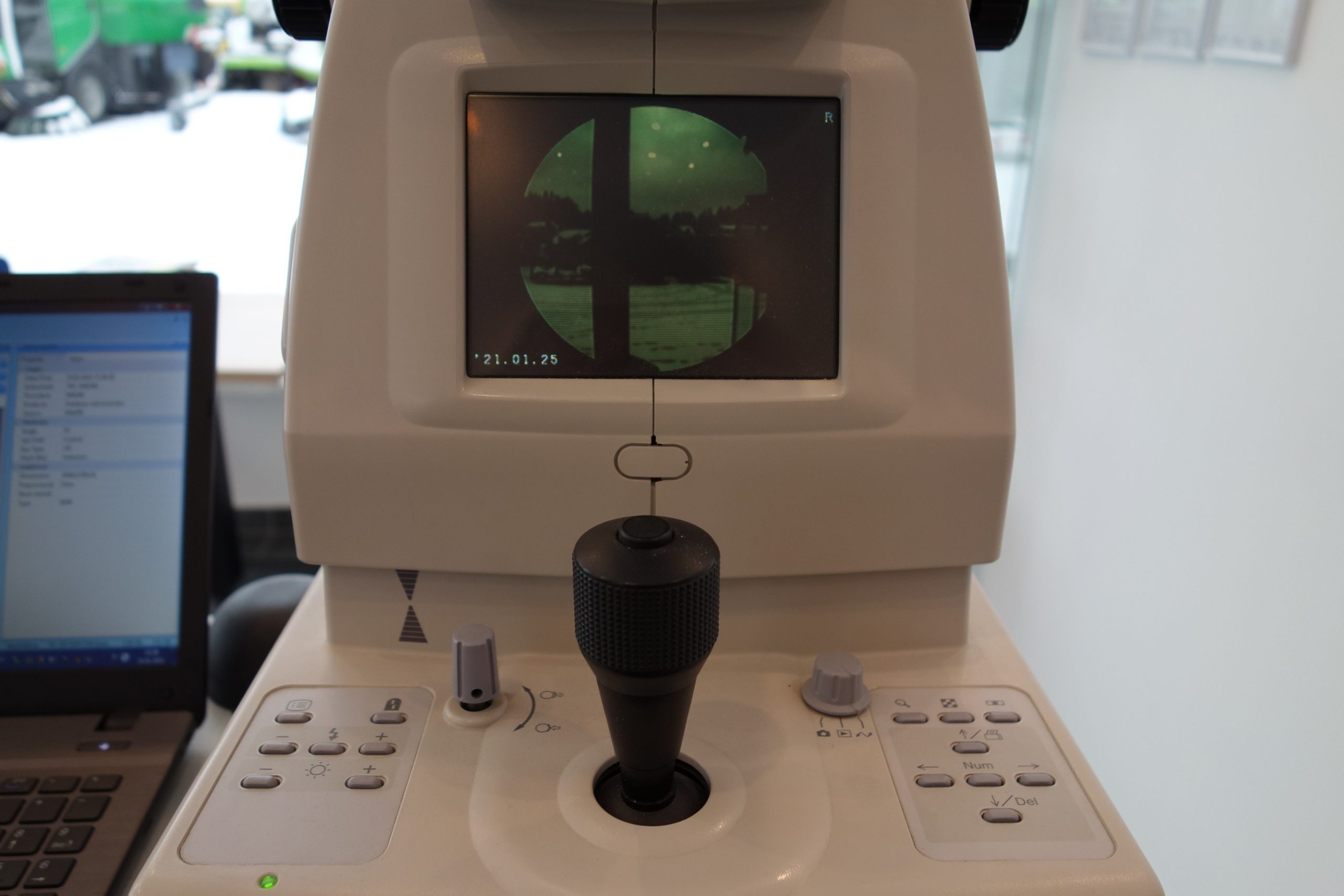 topcon-trc-nw200-non-mydriatic-retinal-camera-funduskamera-2535