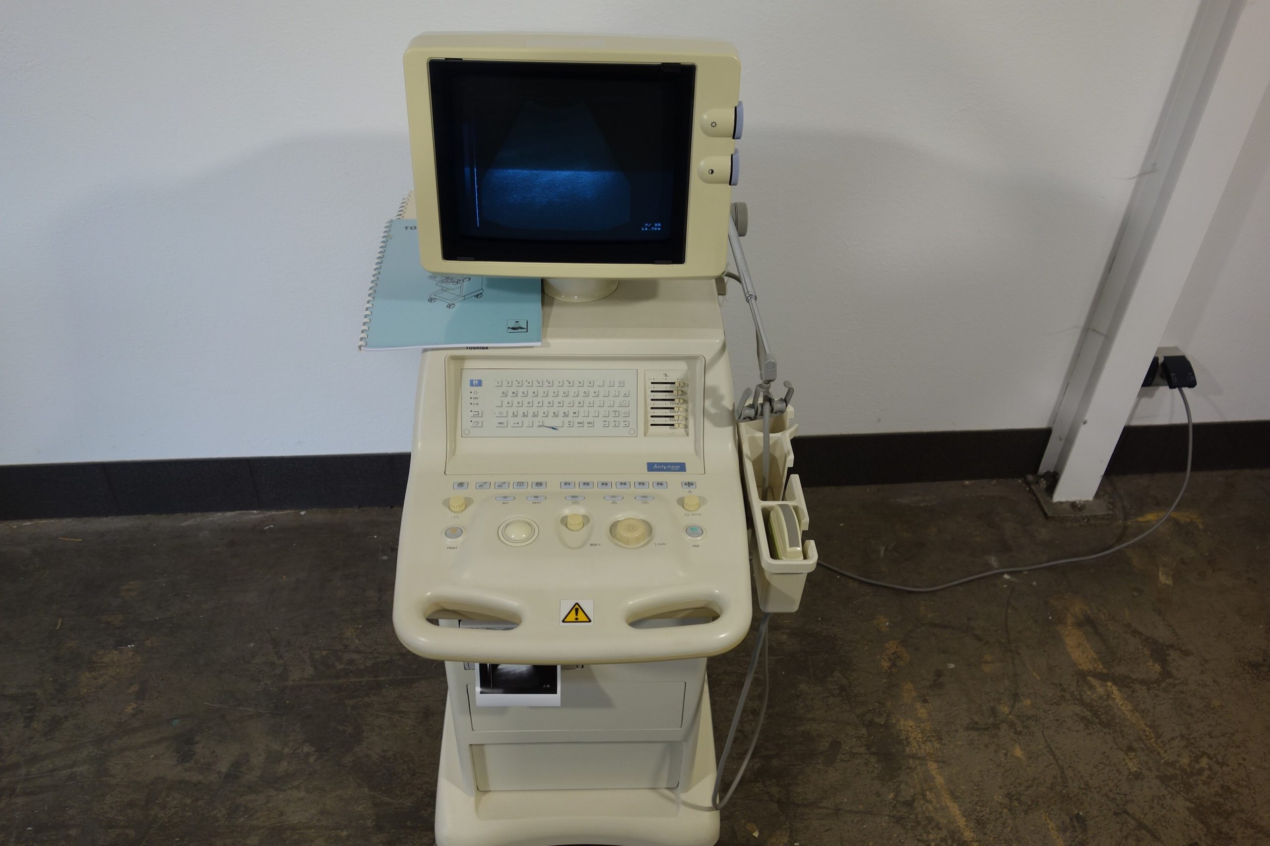 toshiba-justvision-400-mit-convex-sonde-und-printer