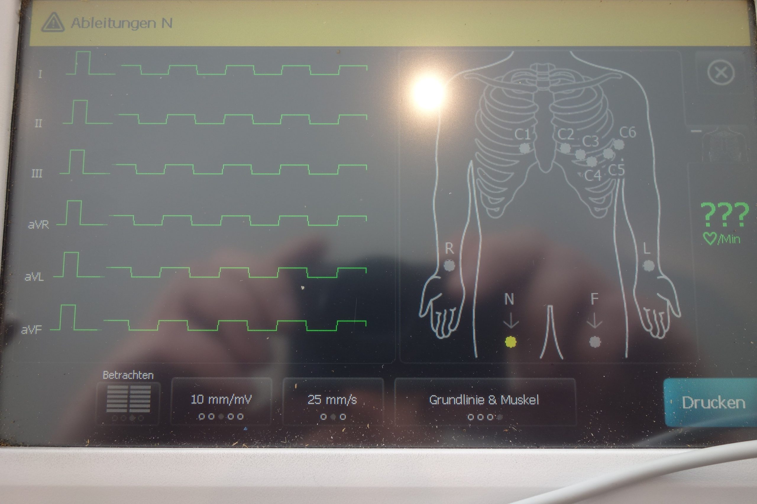 welch-allyn-cp150-ekg-akkubetrieb-netzbetrieb-inkl-patientenkabel-3083